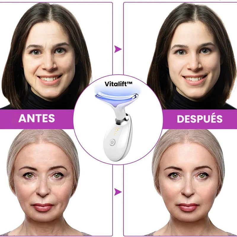 Masajeador Facial Firmeza De La Piel Con Luz Led